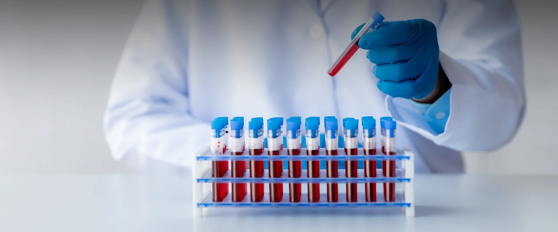 Best Drug and Alcohol Testing Lab in Bedford