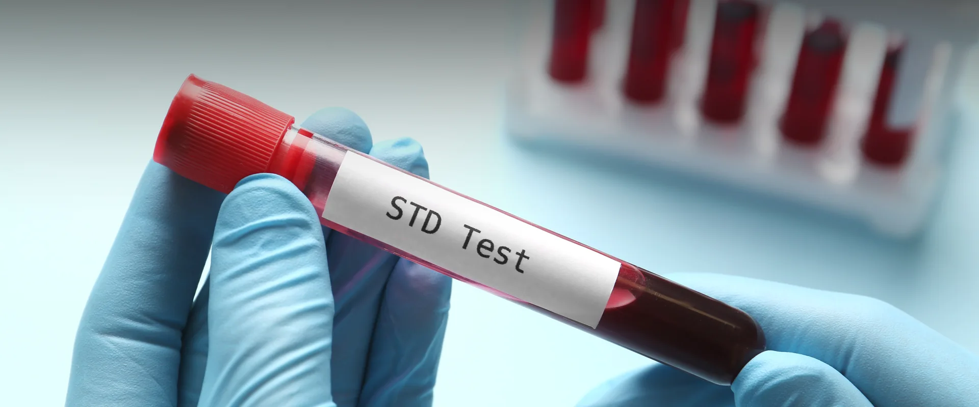 Best STD Lab Test in Bedford
